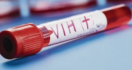 Salta registra entre 300 y 400 positivos de VIH al año: La mayoría están en Capital