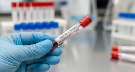 Aumento de casos de Hepatitis A: “La tasa de vacunación en Argentina es de las más bajas en la ...